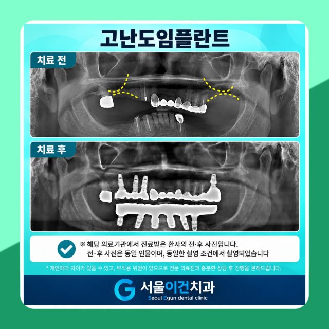 치과 의자에 앉는 게 유독 힘든 분들께 서울이건치과